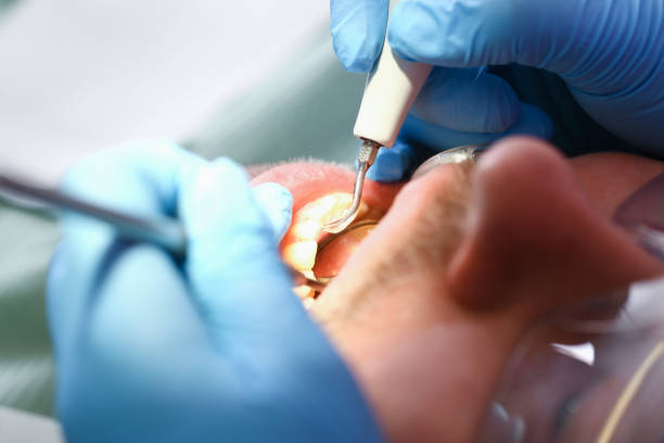 Best Broken or Cracked Tooth Emergency Dentist in Woodbury Heights, NJ